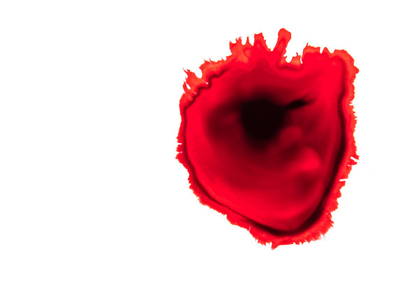 My bleeding heart